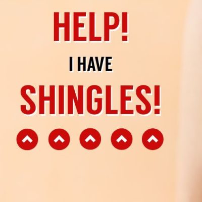 Shingles